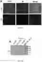 Fig. 09 - Bioengineered lactobacillus probiotics and the uses thereof