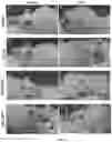 Fig. 14 - Bioengineered lactobacillus probiotics and the uses thereof