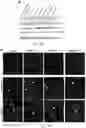 Fig. 17 - Bioengineered lactobacillus probiotics and the uses thereof