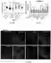 Fig. 20 - Bioengineered lactobacillus probiotics and the uses thereof
