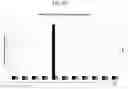 Fig. 09 - Methods of treatment using conditional superagonist CTL ligands for the promotion of tumor-specific CTL responses