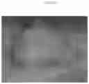 Fig. 02 - Emulsions or microemulsions for use in endoscopic mucosal resectioning and/or endoscopic submucosal dissection