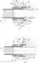 Fig. 01 - CANNULA, CANNULA SYSTEM AND BLOOD PUMP SYSTEM
