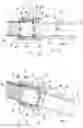 Fig. 05 - CANNULA, CANNULA SYSTEM AND BLOOD PUMP SYSTEM