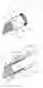Fig. 16 - CANNULA, CANNULA SYSTEM AND BLOOD PUMP SYSTEM