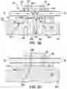 Fig. 07 - Modular blood treatment systems, units, and methods