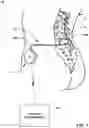 Fig. 02 - Implantable medical pump with pressure sensor