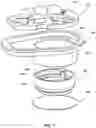 Fig. 09 - Implantable medical pump with pressure sensor