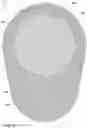 Fig. 11 - Implantable medical pump with pressure sensor