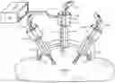 Fig. 01 - Method and system for measuring pressure in a body cavity