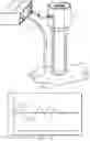 Fig. 02 - Method and system for measuring pressure in a body cavity