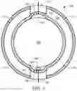 Fig. 04 - Method and system for measuring pressure in a body cavity