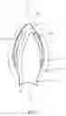 Fig. 04 - Combined laryngeal-bronchial lung separation system