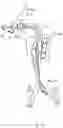 Fig. 15 - Combined laryngeal-bronchial lung separation system