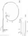 Fig. 03 - Aortic valve no exchange catheter and methods of using the same