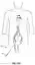 Fig. 07 - Aortic valve no exchange catheter and methods of using the same