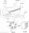 Fig. 08 - Systems, devices and methods for the creation of a therapeutic restriction in the gastrointestinal tract