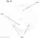Fig. 14 - Catheters and manipulators with articulable ends
