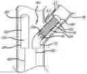 Fig. 01 - SYSTEM AND METHOD FOR DEPLOYING A PROXIMALLY-FLARING STENT