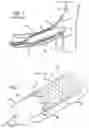 Fig. 02 - SYSTEM AND METHOD FOR DEPLOYING A PROXIMALLY-FLARING STENT