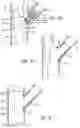 Fig. 03 - SYSTEM AND METHOD FOR DEPLOYING A PROXIMALLY-FLARING STENT