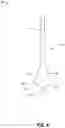 Fig. 05 - Catheter device including a connector