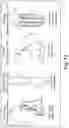 Fig. 16 - Therapy delivery devices and methods for non-damaging neural tissue conduction block