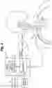 Fig. 03 - Implant tool and improved electrode design for minimally invasive procedure