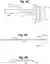 Fig. 05 - Implant tool and improved electrode design for minimally invasive procedure