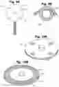 Fig. 09 - Implant tool and improved electrode design for minimally invasive procedure