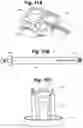 Fig. 11 - Implant tool and improved electrode design for minimally invasive procedure