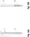 Fig. 08 - Device and method for single-needle in vivo electroporation