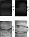 Fig. 16 - Device and method for single-needle in vivo electroporation