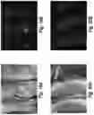 Fig. 17 - Device and method for single-needle in vivo electroporation