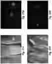 Fig. 18 - Device and method for single-needle in vivo electroporation