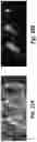 Fig. 20 - Device and method for single-needle in vivo electroporation