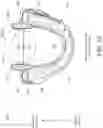 Fig. 06 - METHOD AND APPARATUS FOR TREATING SLEEP APNEA