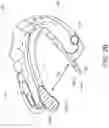 Fig. 07 - METHOD AND APPARATUS FOR TREATING SLEEP APNEA