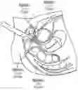 Fig. 01 - Methods for treating urinary stress incontinence