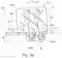 Fig. 03 - Surgical implant system