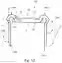 Fig. 04 - Surgical implant system