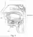 Fig. 08 - Surgical implant system