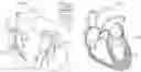 Fig. 01 - Wireless cardiac pace making