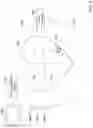 Fig. 05 - Implantable medical device with gyroscope