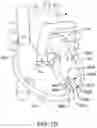 Fig. 09 - Implantable medical device with gyroscope
