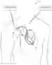 Fig. 01 - Multi-axis coil for implantable medical device