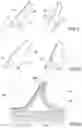 Fig. 04 - Methods for manufacturing elongated structural elements of composite material