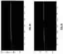 Fig. 10 - Steerable focal adjustment for optical coherence tomography