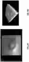 Fig. 16 - Steerable focal adjustment for optical coherence tomography