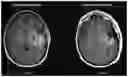 Fig. 01 - 3D radiomic platform for imaging biomarker development